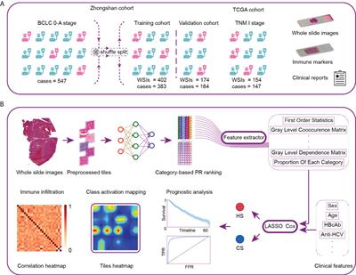 Exploring pathological signatures for predicting the recurrence of early-stage hepatocellular carcinoma based on deep learning